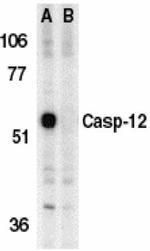 Caspase 12 Antibody in Western Blot (WB)
