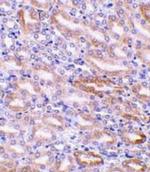 DFFB Antibody in Immunohistochemistry (IHC)