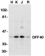 DFFB Antibody in Western Blot (WB)