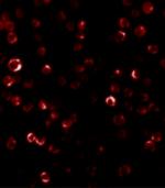 RAIDD Antibody in Immunocytochemistry (ICC/IF)