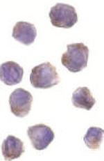 RIP2 Antibody in Immunocytochemistry (ICC/IF)