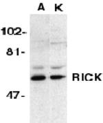 RIP2 Antibody in Western Blot (WB)