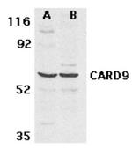 CARD9 Antibody in Western Blot (WB)