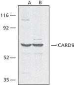 CARD9 Antibody in Western Blot (WB)