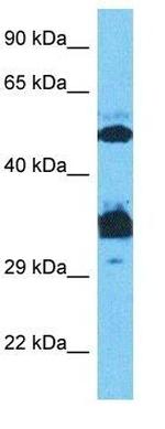 SP7 Antibody in Western Blot (WB)