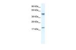 PDCD4 Antibody in Western Blot (WB)