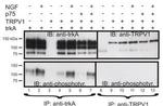 TRPV1 Antibody in Western Blot (WB)