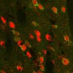 PENK Antibody in Immunohistochemistry (IHC)