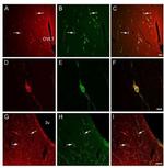 Orphanin FQ Antibody in Immunocytochemistry (ICC/IF)