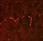 Prodynorphin Antibody in Immunohistochemistry (IHC)