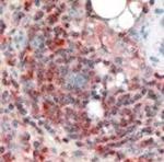 ARPC2 Antibody in Immunohistochemistry (Paraffin) (IHC (P))