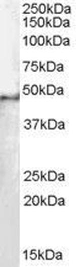 SF3B4 Antibody in Western Blot (WB)