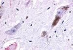 GPR45 Antibody in Immunohistochemistry (Paraffin) (IHC (P))