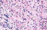 GPR45 Antibody in Immunohistochemistry (Paraffin) (IHC (P))