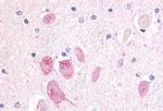 GPR45 Antibody in Immunohistochemistry (Paraffin) (IHC (P))