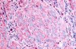 GPR45 Antibody in Immunohistochemistry (Paraffin) (IHC (P))
