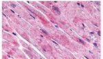 FZD7 Antibody in Immunohistochemistry (Paraffin) (IHC (P))