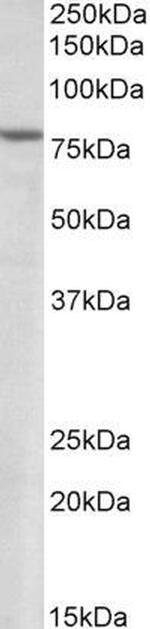 SETDB2 Antibody in Western Blot (WB)