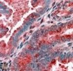 ACTR1B Antibody in Immunohistochemistry (Paraffin) (IHC (P))