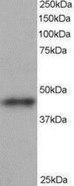 ACTR1B Antibody in Western Blot (WB)
