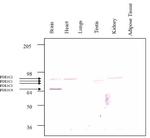 PDE1C Antibody in Western Blot (WB)