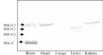 PDE1C Antibody in Western Blot (WB)