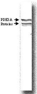PDE3A Antibody in Western Blot (WB)