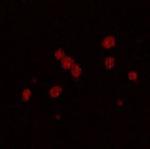 PDE2A Antibody in Immunocytochemistry (ICC/IF)