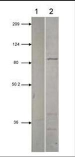 PDE2A Antibody in Western Blot (WB)