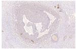 PDE4D Polyclonal Antibody