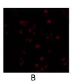 PDE4B Polyclonal Antibody