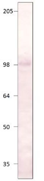 PDE8A Antibody in Western Blot (WB)