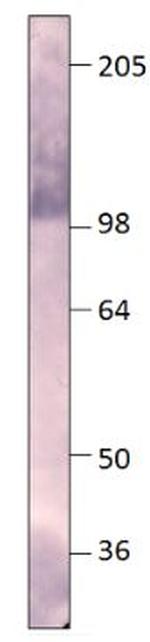 PDE8A Antibody in Western Blot (WB)