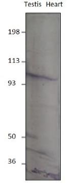 PDE8B Antibody in Western Blot (WB)