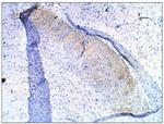 PDE10A Polyclonal Antibody