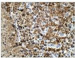 Calretinin Polyclonal Antibody