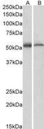 ETEA Antibody in Western Blot (WB)