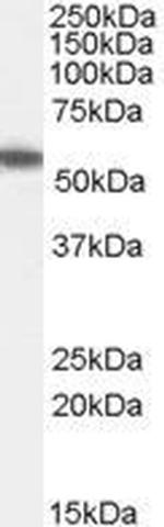 ETEA Antibody in Western Blot (WB)