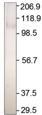 ADCY2 Antibody in Western Blot (WB)