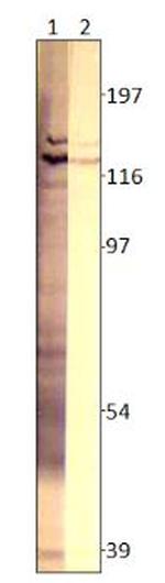 Adenylate Cyclase 3 Antibody in Western Blot (WB)