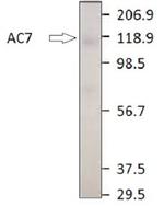 Adenylate Cyclase 7 Antibody in Western Blot (WB)