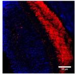 PGCF Antibody in Immunohistochemistry (IHC)