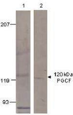 PGCF Antibody in Western Blot (WB)