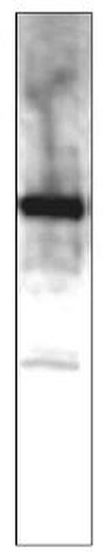 MERTK Polyclonal Antibody