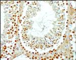 SCP3 Antibody in Immunohistochemistry (Paraffin) (IHC (P))