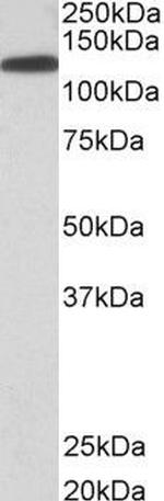 Kinesin 5B Antibody in Western Blot (WB)