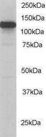 Kinesin 5B Antibody in Western Blot (WB)