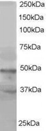 BAF53A Polyclonal Antibody