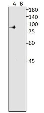 Lactoferrin Polyclonal Antibody