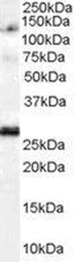 Importin 7 Antibody in Western Blot (WB)